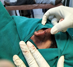 ENT Service Image 3